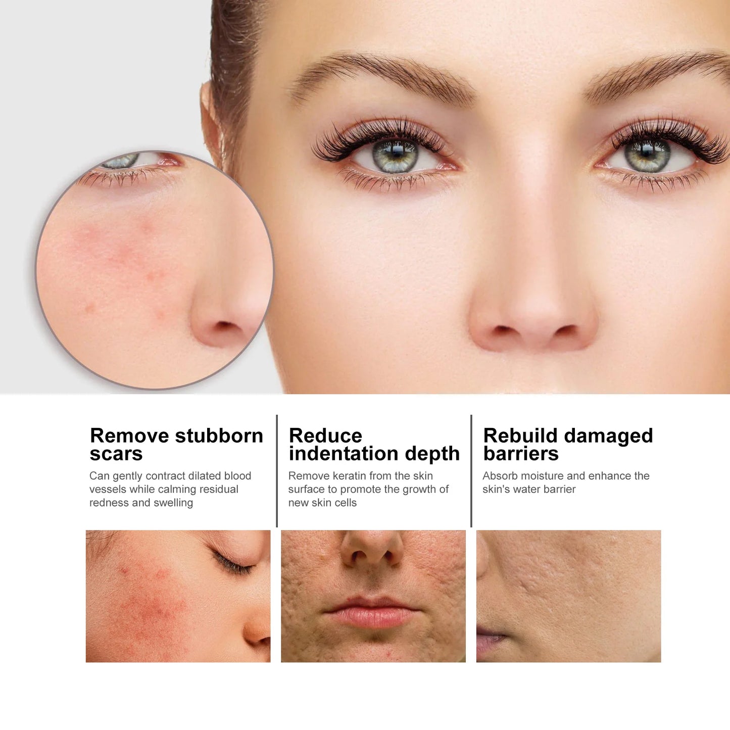 Niacinamide Facial Serum: fades acne marks, hydrates and moisturizes, minimizes pores, brightens skin, skin-beautifying essence.