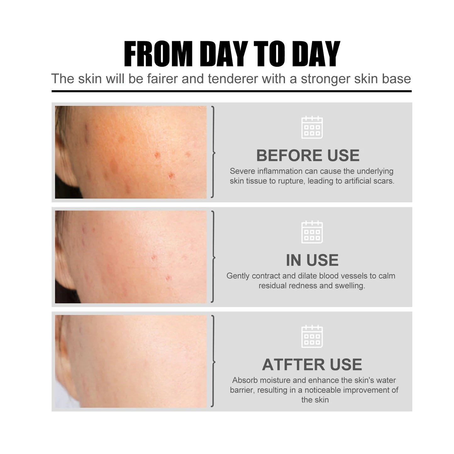 Niacinamide Facial Serum: fades acne marks, hydrates and moisturizes, minimizes pores, brightens skin, skin-beautifying essence.