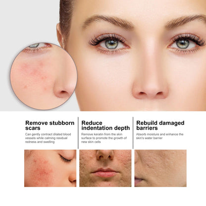 Niacinamide Facial Serum: fades acne marks, hydrates and moisturizes, minimizes pores, brightens skin, skin-beautifying essence.